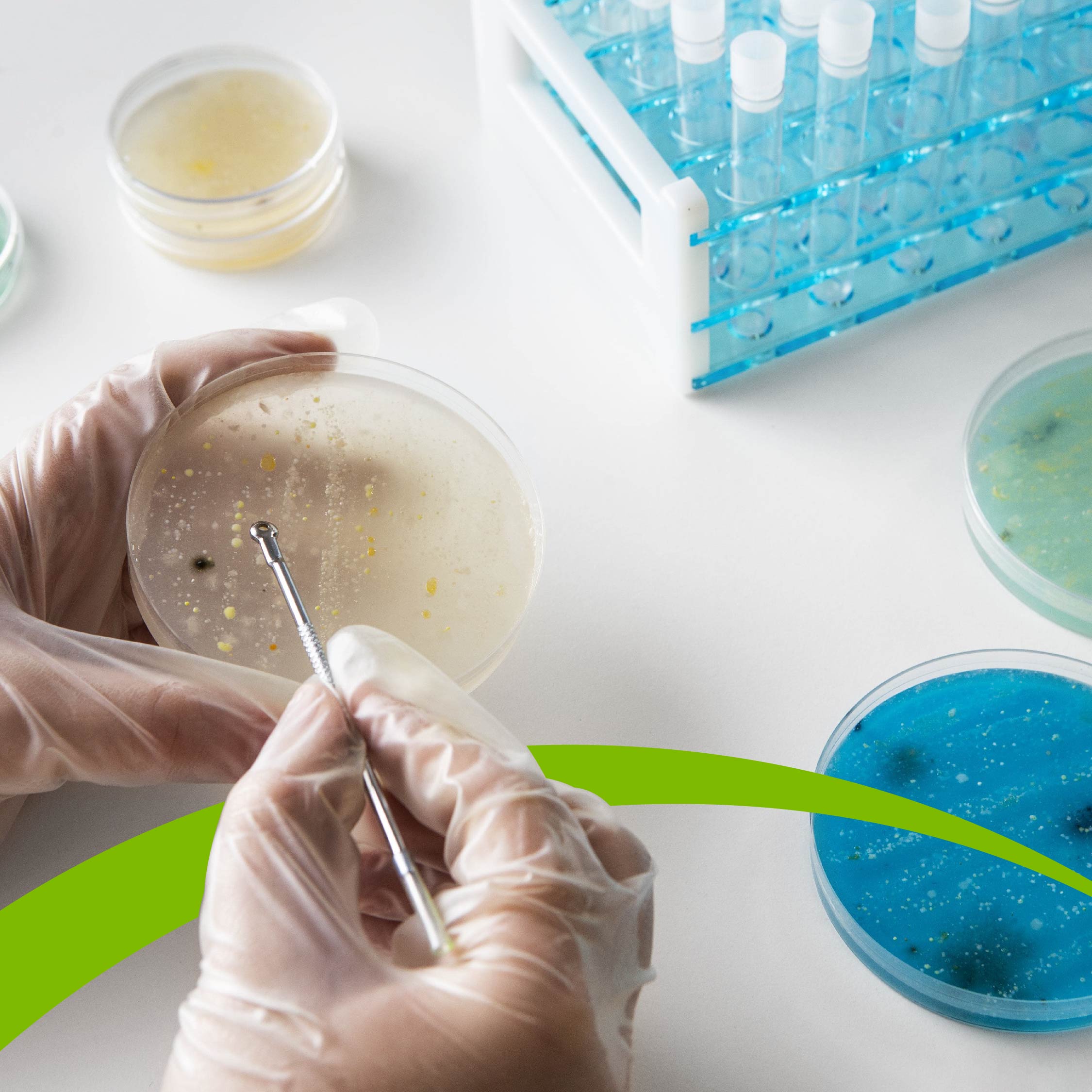 Carolina Manríquez, experta de Bionova: “El patógeno más preocupante para la industria alimentaria es la Listeria monocytogenes”