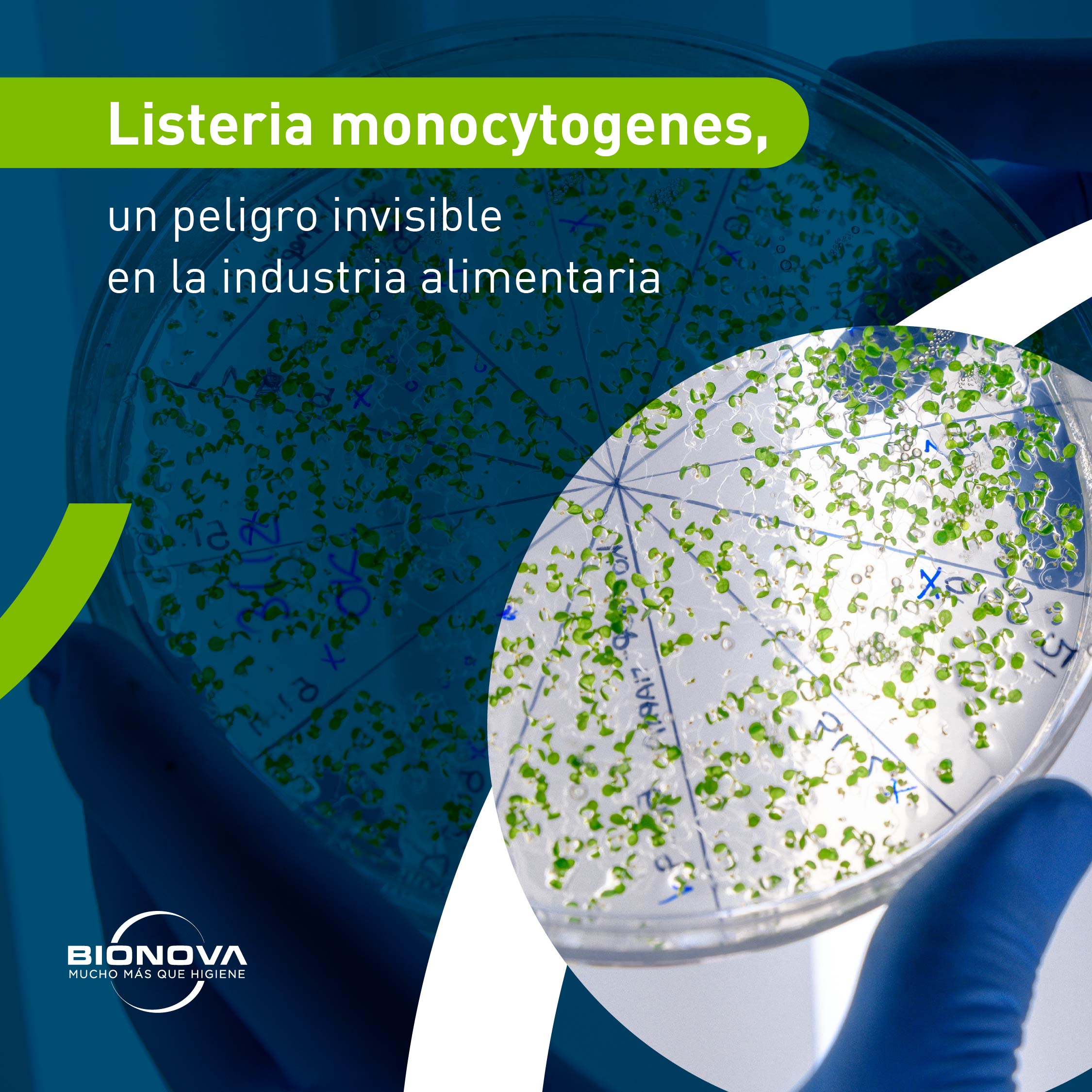 Listeria: el peligro invisible de la industria alimentaria